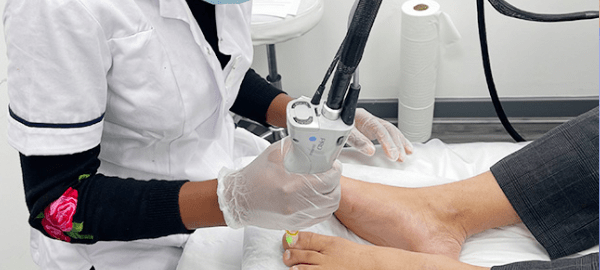 Laser Nail Fungus Treatment