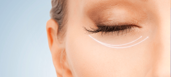 Laser Skin Rejuvenation
